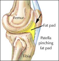 Anterior Knee pain – Part II